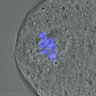 Thumbnail for dataset FigureS3A_misalign_20160717_ACA_after