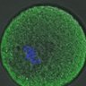 Thumbnail for dataset FigureS3A_misalign_20160909_ACA_half