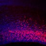 Thumbnail for dataset Fig1G_E15.5WT_Tbr2+DAPI_highmagnification
