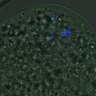 Thumbnail for FigureS3A_misalign_20161104_kinetochore_Hec1_EFcon