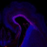 Thumbnail for dataset Fig1G_E17.5WT_Tbr2+DAPI