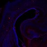 Thumbnail for dataset Fig1G_P0WT_Tbr2+DAPI