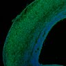 Thumbnail for dataset Fig1I_E17.5Tg_NeuN