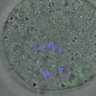 Thumbnail for FigureS4_kinetochore_MCAK_20170308_half
