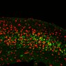 Thumbnail for dataset Fig3A_Tg_EdUE12.5_EdU+Ctip2