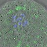 Thumbnail for FigureS4_kinetochore_MCAK_20170310_con