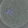 Thumbnail for dataset FigureS4_kinetochore_MCAK_20170310_half