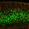Thumbnail for dataset Fig3E_Tg_EdUE14.5_EdU+Ctip2