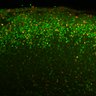 Thumbnail for dataset Fig3E_Tg_EdUE14.5_EdU+Cux1