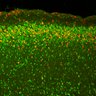 Thumbnail for dataset Fig3E_WT_EdUE14.5_EdU+Cux1