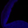Thumbnail for dataset FigS1A_E15.5Tg_cleaved-caspase3+DAPI