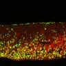 Thumbnail for dataset FigS2A_EduE14_12h_Tg_EdU+Pax6