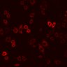 Thumbnail for dataset Figure2B_2pabPACY72L_post1P
