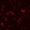Thumbnail for dataset Figure2B_2pabPACY72L_pre