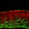 Thumbnail for dataset FigS2E_EduE14_12h_Tg_EdU+Tuj1