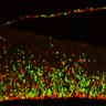 Thumbnail for dataset FigS2G_EdUE14_12h_Tg_EdU+Ki67