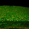 Thumbnail for dataset FigS3C_EdU11.5_Tg_EdU+Tbr1