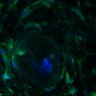 Thumbnail for dataset Fig3B_BlvraKO_Earskin_mouse2_1