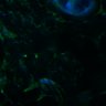 Thumbnail for dataset Fig3B_BlvraKO_Earskin_mouse3_2