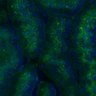 Thumbnail for dataset Fig3B_BlvraKO_Kidney_mouse1_1
