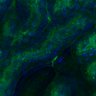 Thumbnail for dataset Fig3B_BlvraKO_Kidney_mouse1_2