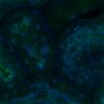 Thumbnail for dataset Fig3B_BlvraKO_Kidney_mouse2_1