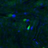 Thumbnail for dataset Fig3B_BlvraKO_Liver_mouse1_1