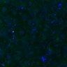 Thumbnail for dataset Fig3B_BlvraKO_Liver_mouse4_2
