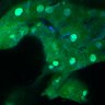 Thumbnail for dataset Fig3B_BlvraKO_Pancreas_mouse2_3