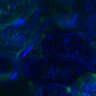 Thumbnail for dataset Fig3B_WT_Kidney_mouse1_1