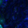 Thumbnail for dataset Fig3B_WT_Kidney_mouse3_2