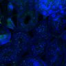 Thumbnail for dataset Fig3B_WT_Kidney_mouse4_2