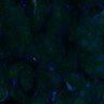 Thumbnail for dataset Fig3B_WT_Liver_mouse3_1