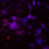 Thumbnail for dataset Fig4C_N2_WT1