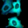 Thumbnail for dataset Fig1B_No2_beforeFSK