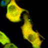 Thumbnail for dataset Fig1B_No4_afterFSK