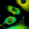 Thumbnail for dataset Fig1B_No6_beforeFSK