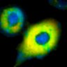 Thumbnail for dataset Fig1B_No7_beforeFSK