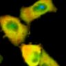 Thumbnail for dataset Fig1B_No13_afterFSK