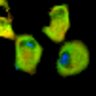 Thumbnail for dataset Fig1B_No16_afterFSK
