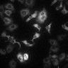 Thumbnail for dataset Figure5B_ISO_HeLa_Isotiteration_thumb_w3mKO2
