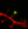 Thumbnail for dataset Fig3a_KO_DsRed2_PAGFP_post