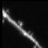 Thumbnail for dataset Fig5A_Tiam_delataPHnCCEx_EGFP_C2