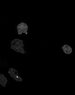 Thumbnail for dataset Fig3C_WT_PHPKB-GFP_sGCN-TMR