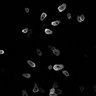 Thumbnail for dataset Fig4A_sGCcat-GFP_cAMP