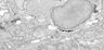 Thumbnail for FIB-SEM1-430_actinotrichia