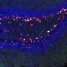 Thumbnail for dataset FigS6M-P_hippocampal_dentate_14day