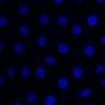 Thumbnail for dataset Fig4H_csTreh_E3rd