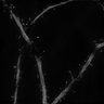 Thumbnail for Fig5i_spines_SIM_EGFP_control9