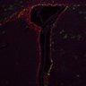 Thumbnail for dataset SuppFig4a_SVZ4_10z
